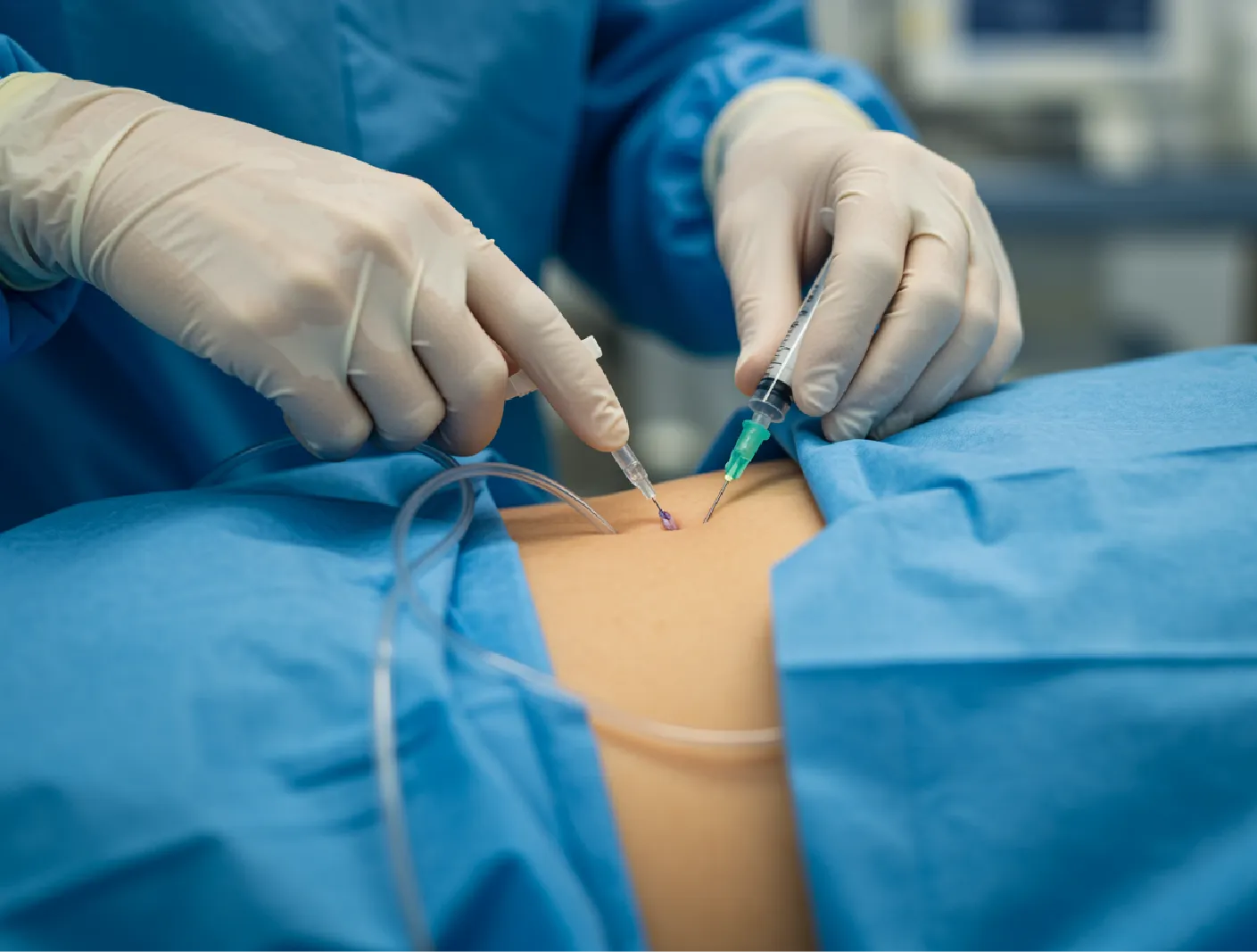 Diagnosis & Treatment